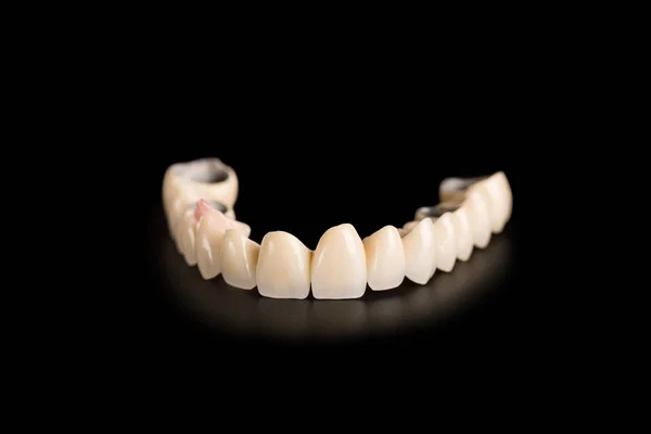 Denture isolated on black background — Stock Photo, Image