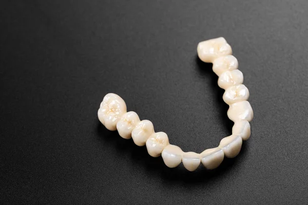 Denture on black background — Stock Photo, Image