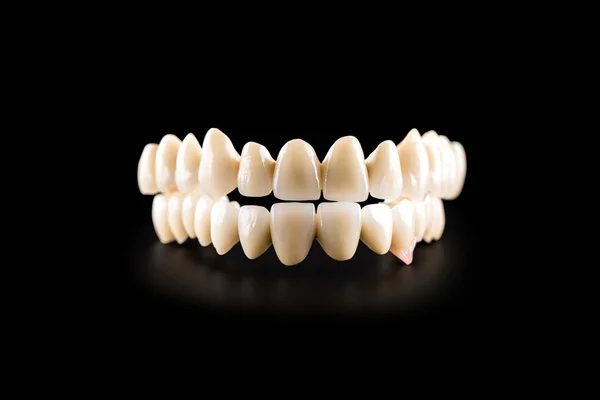 Ponte in ceramica dentale su sfondo nero isolato — Foto Stock