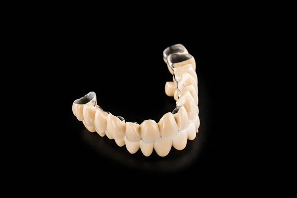 Denture on black background — Stock Photo, Image