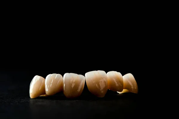 Denti Ceramica Bianca Isolati Sfondo Nero — Foto Stock