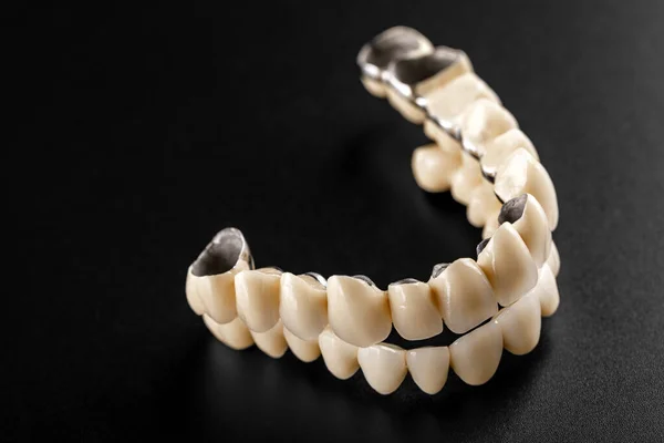 White Ceramic Teeth Isolated Black Background — Stock Photo, Image