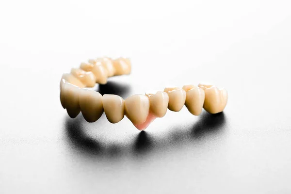 Denti Ceramica Bianca Isolati Sfondo Nero — Foto Stock