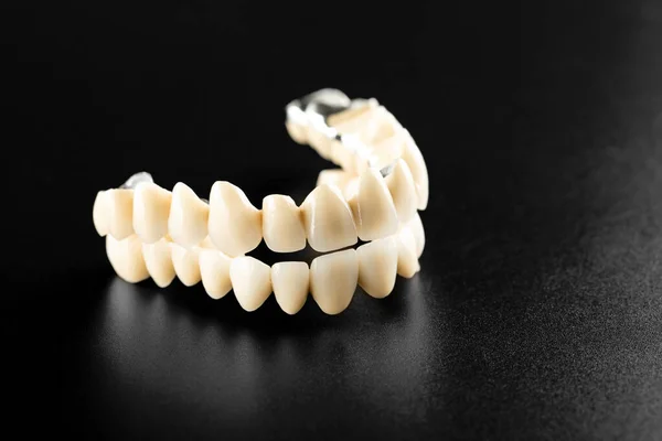 Denti Ceramica Bianca Isolati Sfondo Nero — Foto Stock