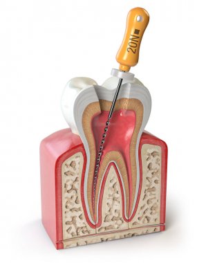 Cross section of Human tooth with endodontic file isolated on wh clipart