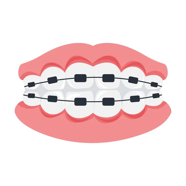 Teeth Braces Illustration White Background — Stock Vector
