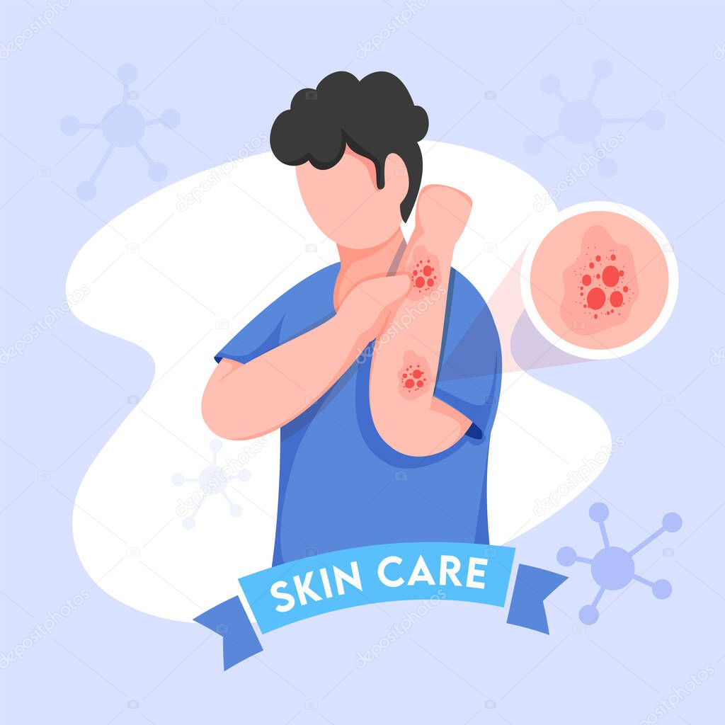 Cartoon Young Boy Itching His Hands and Molecules Decorated on Blue Background for Skin Care.