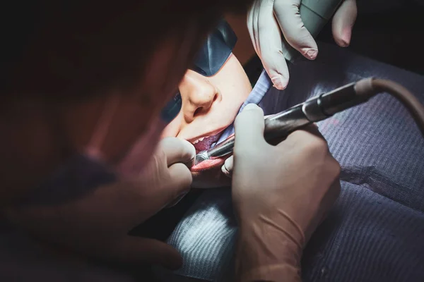 Proces van tandheelkundige werking voor kleine jongen — Stockfoto