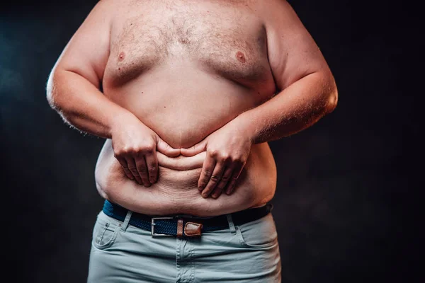 Buclatý muž ukazuje své obrovské břicho a zobrazuje úsměv ze záhybů své kůže — Stock fotografie