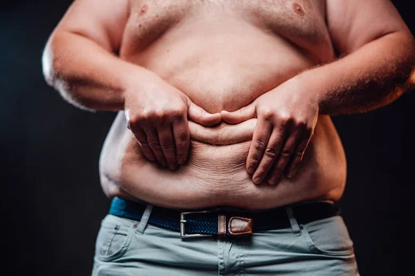 Hombre grueso muestra su enorme vientre y representa una sonrisa de los pliegues de su piel — Foto de Stock