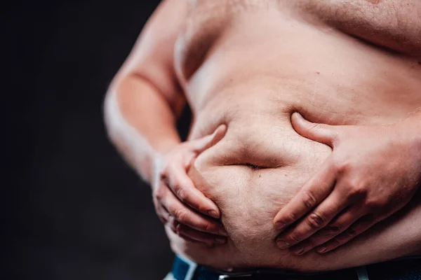 Hombre muy gordo muestra su enorme vientre — Foto de Stock