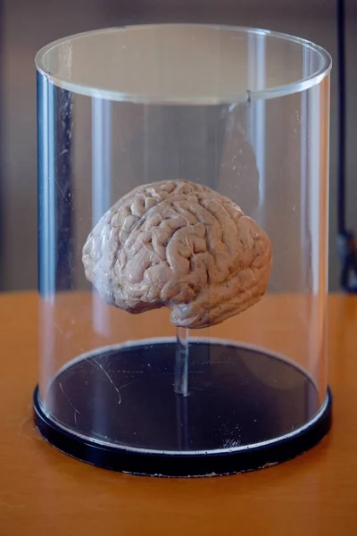 Макет мозку в пляшках. Музейна експозиція — стокове фото