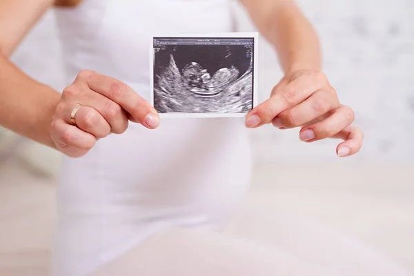 Ultrason Taraması Closeup Tutan Hamile Kadın — Stok fotoğraf