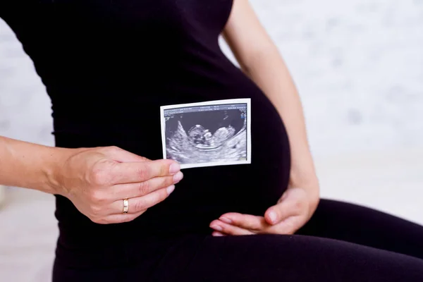 Primer Plano Mujer Mirando Fotos Usg Pequeño Bebé —  Fotos de Stock