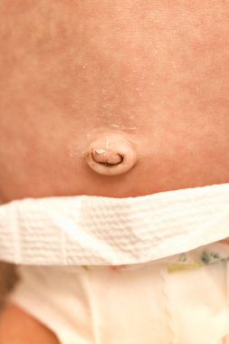 Yeni doğan bebeğin göbeğine yakın çekim. İyileştikten sonra göbek. Bir haftalık bebek. Mutlu Aile kavramı. Güzel bir bebek ve bebek fotoğrafı. Yaşam biçimi.