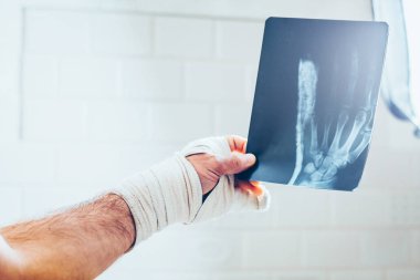 Hasta elin bir x-ışını inceliyor