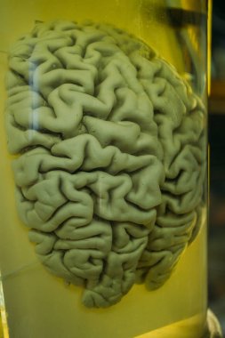 Tıbbi çalışmalar için formaldehit ile cam kavanozda insan beyni
