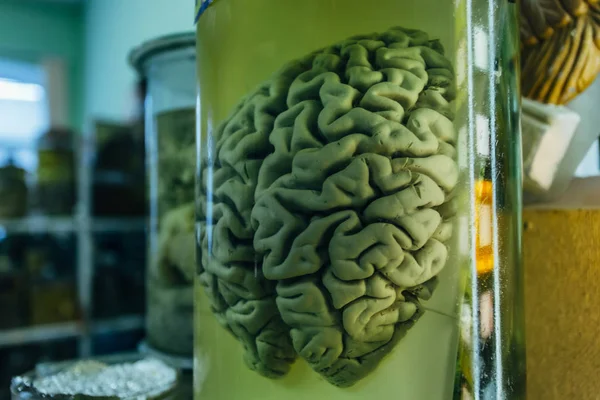 Human brain in glass jar with formaldehyde for medical studies — Stock Photo, Image