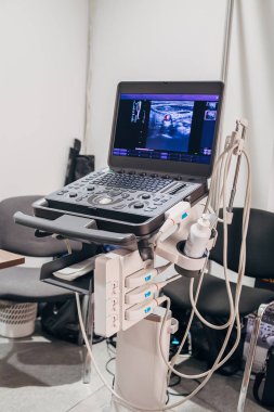 Sonografi kliniğindeki modern ultrason makinesi.