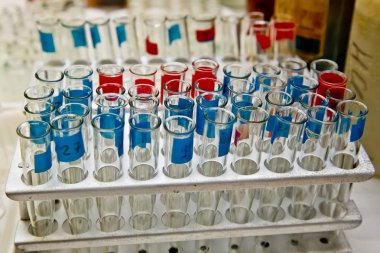 Laboratuvarda analiz için işaretlenmiş test tüpleri açıldı