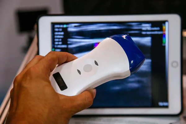 Sonografi tanılama kliniğinde modern taşınabilir ultrason makinesi.
