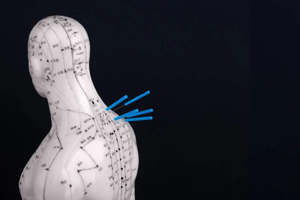 Akupunktur Modell Med Nålar Isolerad Svart Bakgrund — Stockfoto