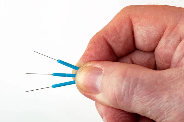 Vinger Houdt Acupunctuur Naalden Geïsoleerd Witte Achtergrond — Stockfoto