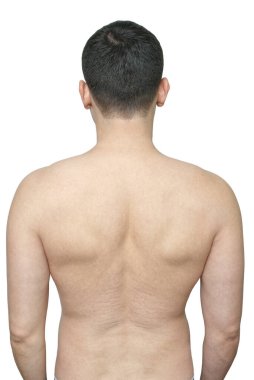 Beyaz tenli, esneme izleri olan bir adamın arkasında.