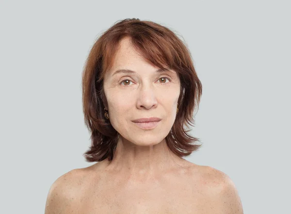 Reife Frau Auf Weiß Gesichtslifting Kosmetologie Ästhetische Medizin Und Konzept — Stockfoto