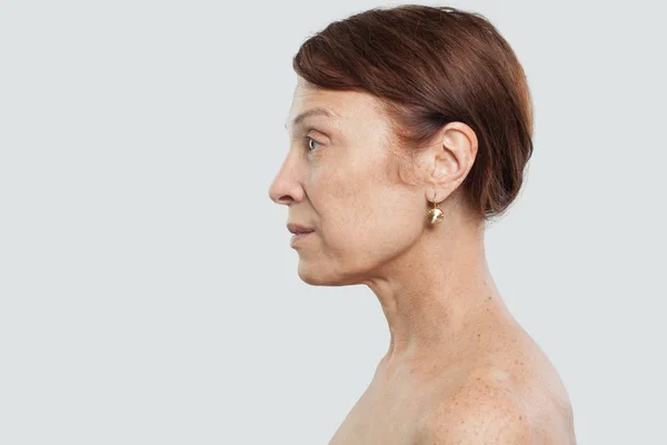 Olgun Kadın Portresi Yüz Tedavi Kozmetik Estetik Tıp Kavramı — Stok fotoğraf