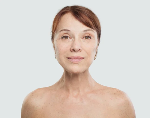 Mid Adult Woman Face White Background Facial Treatment Aesthetic Medicine — Stock Photo, Image