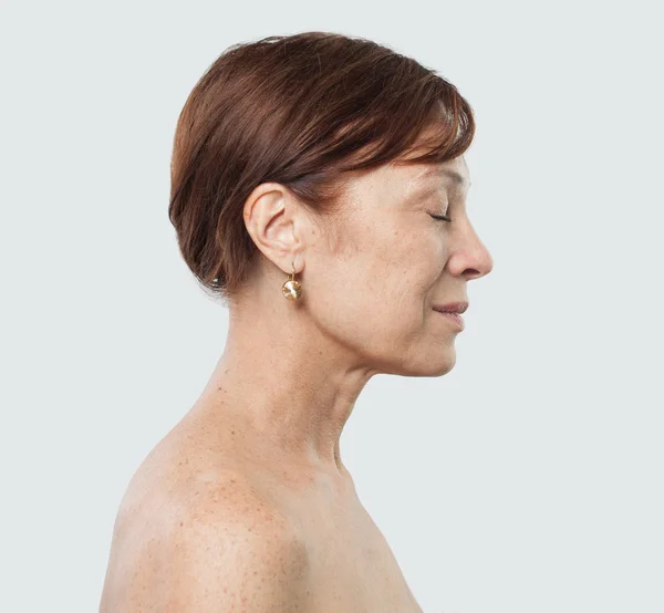 Cara Feminina Madura Perfil Tratamento Facial Cosmetologia Medicina Estética Cirurgia — Fotografia de Stock