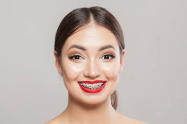 Diş teli takan mutlu bir kız beyaz, güzel bir kadın yüzü. Yaklaş.