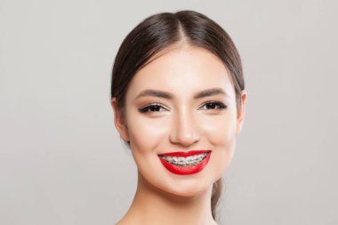 Diş teli takan neşeli bir kadın. Beyaz arka planda gülümseyen diş telleriyle güzel bir model.