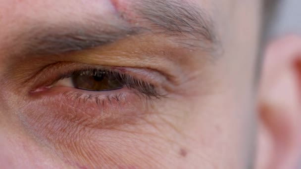 El primer plano del ojo masculino guapo está mirando a la cámara: la ceja está cortada y el moretón debajo del ojo — Vídeo de stock