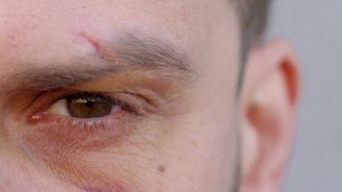 Yakın çekim yakışıklı erkek göz kameraya bakıyor - kaş kesik ve çürük göz altında