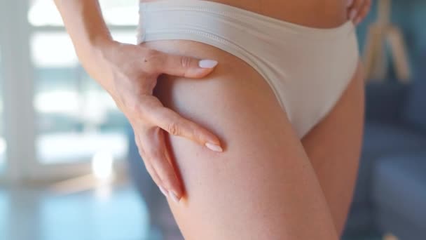 Woman compressing skin of the hips and checks for stretch marks and cellulite — Stock Video