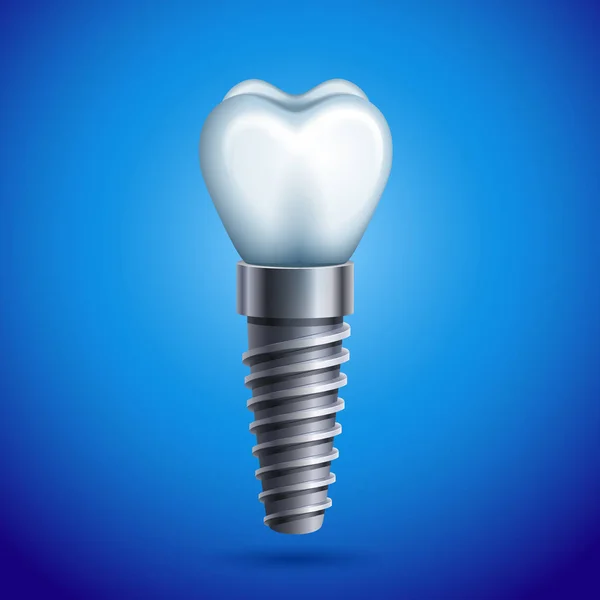 Vectorillustratie Dental Implant Pictogram Rechtenvrije Stockvectors