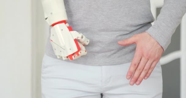 Il paziente sta testando la sua nuova mano protesica robotica la prima volta. . — Video Stock