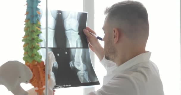 Arzt lernt Knochen auf Röntgenbildern, die am Fenster stehen. — Stockvideo