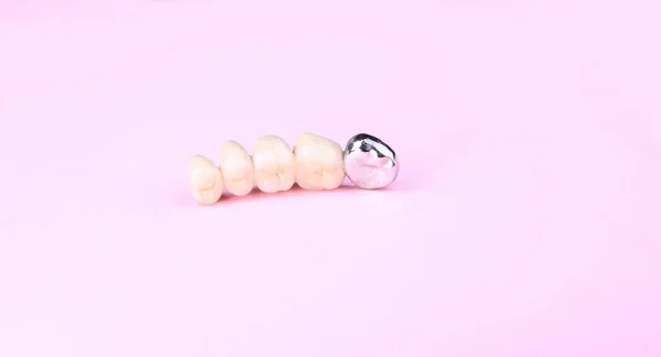 Prótese Dentária Fundo Rosa — Fotografia de Stock