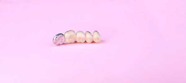 Zahnprothese Auf Rosa Hintergrund — Stockfoto