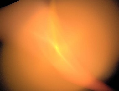 Siyah Renk Üzerine Bir Dijital Fraktal Resmi