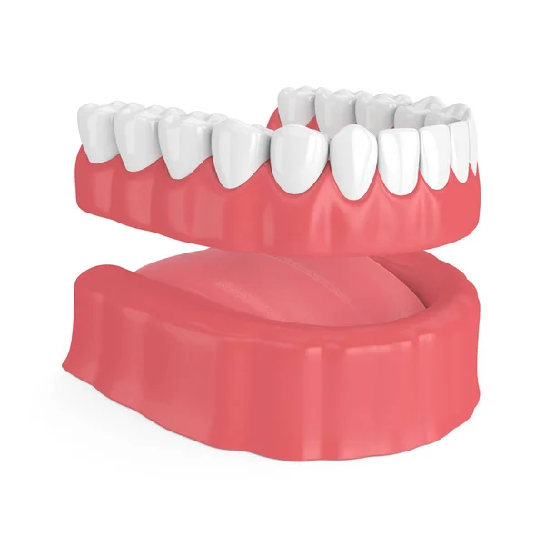 Рендеринг Съемного Полного Зубного Протеза Белом Фоне — стоковое фото