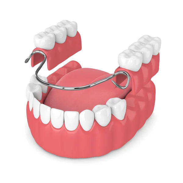 Beyaz arka plan üzerinde izole çıkarılabilir kısmi takma diş 3D render