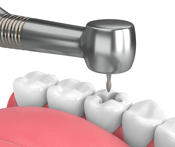 3d рендеринг челюсти с зубным наконечником и сверла изолированы на белом
