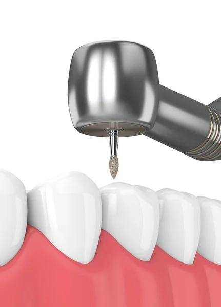 Renderizado Mandíbula Con Pieza Mano Dental Taladro Aislado Sobre Blanco — Foto de Stock