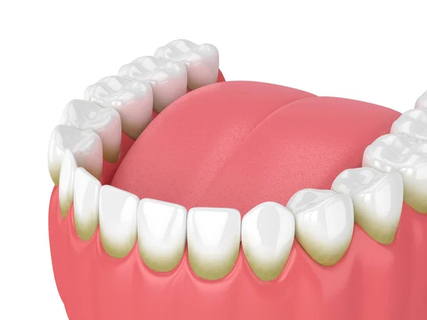 Rendu Des Dents Avec Plaque Tartre Sur Fond Blanc — Photo