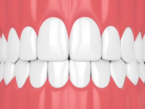 Darstellung Des Kiefers Mit Zähnen Zahnmedizinisches Konzept — Stockfoto
