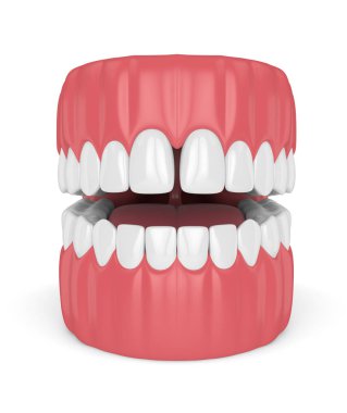 Diş beyaz arka plan üzerinde diastema ile 3D render
